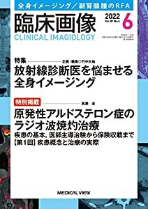 臨床画像 2022年6月号 特集:特集:放射線診断医を悩ませる全身イメージング/特別掲載:原発性アルドステロン症のラジオ波焼灼治療(