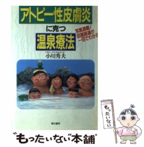 【中古】 アトピー性皮膚炎に克つ温泉療法 写真満載！回復経過が一目でわかる / 小川 秀夫 / 現代書林 [単行本]【メール便送料無料】