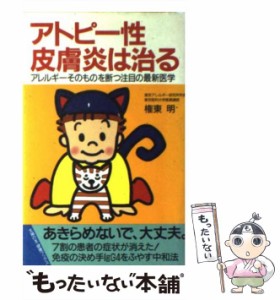 【中古】 アトピー性皮膚炎は治る / 権東 明 / 主婦の友社 [単行本]【メール便送料無料】