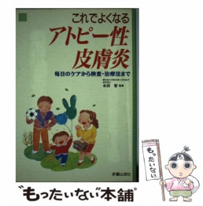 【中古】 これでよくなるアトピー性皮膚炎 毎日のケアから検査・治療法まで / 新星出版社 / 新星出版社 [単行本]【メール便送料無料】