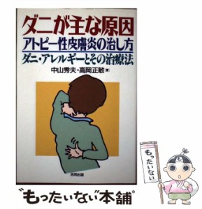 【中古】 ダニが主な原因、アトピー性皮膚炎の治し方 ダニ・アレルギーとその治療法 / 中山 秀夫、 高岡 正敏 / 合同出版 [単行本]【メー