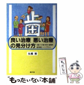 【中古】 歯 良い治療悪い治療の見分け方 虫歯・入れ歯・咬合・歯周病・歯列矯正・インプラント （健康双書） / 丸橋 賢 / 農山漁村文化