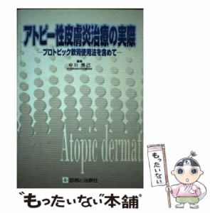 【中古】 アトピー性皮膚炎治療の実際 プロトピック軟膏使用法を含めて / 中川 秀己 / 診断と治療社 [単行本]【メール便送料無料】