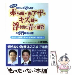 【中古】 医師による切らない「赤ら顔・赤アザ・キズ跡・浮き出た青い血管」の専門最新治療 改訂版 / 山本博意 / 白誠書房 [単行本]【メ