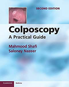 Colposcopy: A Practical Guide(中古品)