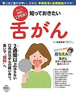 それって本当に口内炎? 知っておきたい舌がん (扶桑社ムック)(中古品)