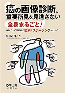 癌の画像診断、重要所見を見逃さない?全身まるごと! 各科でよく診る癌の鑑別とステージングがわかる(中古品)