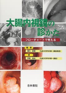 大腸内視鏡の診かた―フローチャートで考える(中古品)