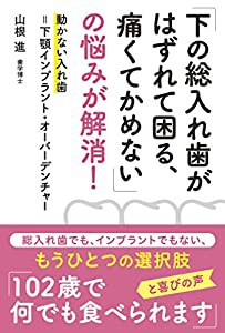 「下の総入れ歯がはずれて困る、痛くてかめない」の悩みが解消! 動かない入れ歯=下顎インプラント・オーバーデンチャー(中古品)