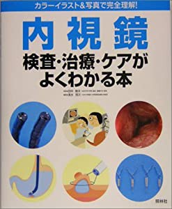 内視鏡検査・治療・ケアがよくわかる本(中古品)