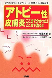 アトピー性皮膚炎 ここまでわかった!ここまで治る!!—専門医だから言えるアトピーのメカニズムと最新治療(中古品)