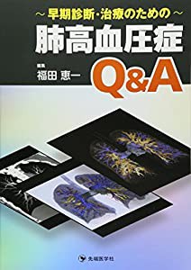 早期診断・治療のための肺高血圧症Q&A(中古品)