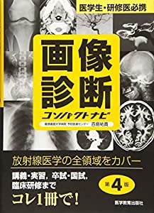 画像診断コンパクトナビ―医学生・研修医必携 (コンパクトナビシリース)(中古品)