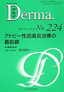 アトピー性皮膚炎治療の最前線 (MB Derma(デルマ))(中古品)