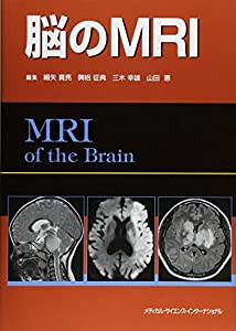 脳のMRI(中古品)