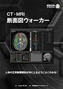 CT・MRI 断面図ウォーカー(中古品)