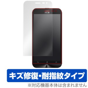 ASUS ZenFone 2 Laser (ZE500KL) 保護フィルム OverLay Magic for ASUS ZenFone 2 Laser (ZE500KL) 液晶 保護 フィルム シート シール キ