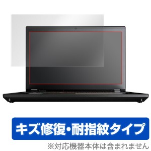 ThinkPad P70 (タッチパネル機能非搭載モデル) 保護フィルム OverLay Magic for ThinkPad P70 (タッチパネル機能非搭載モデル) / 液晶 保