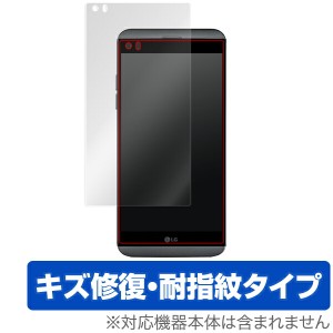 LG V20 LGH990DS 保護フィルム OverLay Magic for LG V20 LGH990DS液晶 保護 フィルム シート シール フィルター キズ修復 耐指紋 防指紋