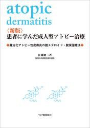 〈新版〉患者に学んだ成人型アトピー治療　難治化アトピー性皮膚炎の脱ステロイド・脱保湿療法