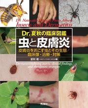 Ｄｒ．夏秋の臨床図鑑　虫と皮膚炎