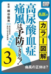 名医がカラー図解！　高尿酸血症・痛風は予防できる！　（３）　痛風の正体は？