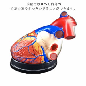 心臓バイパス付 2分解モデル 心臓模型 4倍拡大 大 右心房 左心房 右心室 左心室 人体模型 4D モデル 目 心臓 模型 解剖 教材 模型 診察 