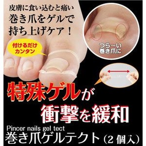 巻き爪ゲルテクト(巻き爪補正ゲルマサポーター)