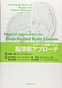 カダバーと動画で学ぶ脳深部アプローチ(中古品)