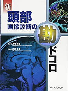 新 頭部画像診断の勘ドコロ(中古品)