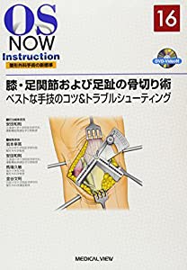 膝・足関節および足趾の骨切り術?ベストな手技のコツ&トラブルシューティング [DVD付] (OS NOW Instruction)(中古品)