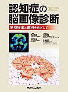 認知症の脳画像診断?早期検出と鑑別をめざして(中古品)