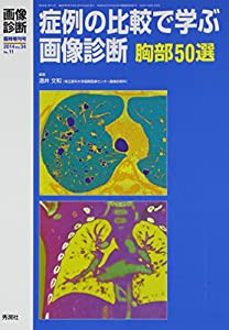 症例の比較で学ぶ画像診断 胸部50選(中古品)