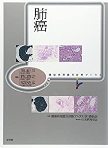 肺癌 (腫瘍病理鑑別診断アトラス)(中古品)