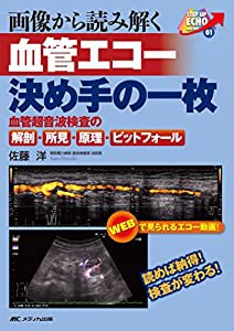 画像から読み解く 血管エコー 決め手の一枚: 読めば納得! 血管超音波検査の解剖・所見・原理・ピットフォール(中古品)