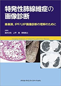 特発性肺線維症の画像診断 蜂巣肺,IPF/UIP画像診断の理解のために(中古品)