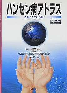 ハンセン病アトラス―診断のための指針(中古品)