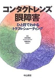 コンタクトレンズ眼障害―ひと目でわかるトラブルシューティング(中古品)