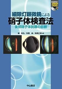 細隙灯顕微鏡による硝子体検査法―後部硝子体剥離の診断(中古品)