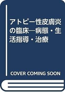 アトピー性皮膚炎の臨床―病態・生活指導・治療(中古品)