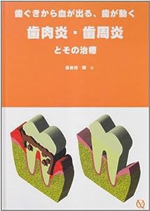 歯ぐきから血が出る、歯が動く 歯肉炎・歯周炎とその治療(中古品)