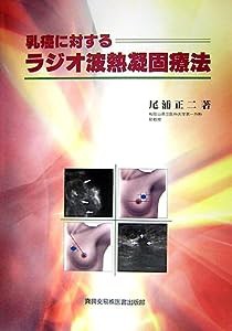 乳癌に対するラジオ波熱凝固療法(中古品)