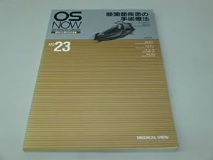 膝関節疾患の手術療法 (OS NOW—新時代の整形外科治療)(中古品)