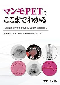 マンモPETでここまでわかる?乳房専用PETによる新しい乳がん画像診断?(中古品)