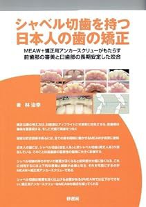 シャベル切歯を持つ日本人の歯の矯正—MEAW+矯正用アンカースクリューがもたらす前歯部(中古品)