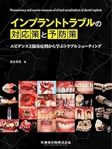 インプラントトラブルの対応策と予防策(中古品)