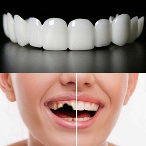 入れ歯 義歯 付け歯 2組の男女は即時に義歯を貼り インスタント入れ歯 差し歯接着剤簡易 男女兼用 簡単装着 部分付け歯 自信を持って微笑