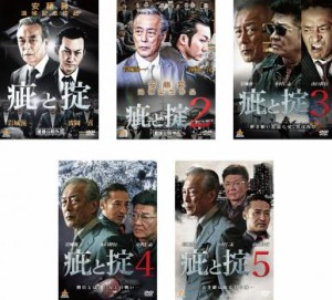 cs::ケース無:: 疵と掟 全5枚 1、2、3、4、5 中古DVD 全巻セット レンタル落ち