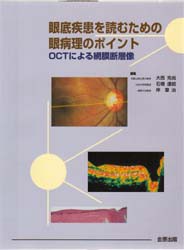 眼底疾患を読むための眼病理のポイント OCTによる網膜断層像 [本]