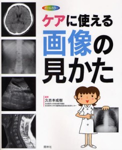 ケアに使える画像の見かた X線写真・CT画像・エコー像・MRI [本]